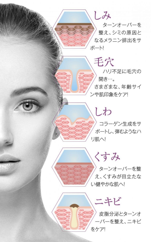 【人気急上昇！BBL光フェイシャル！】