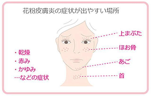 【この時期に気をつけること】