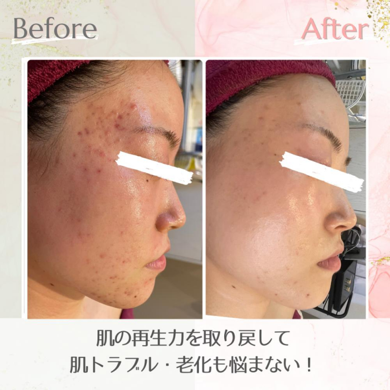 当日ご予約大歓迎です☆