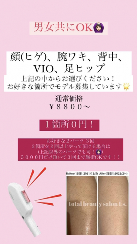 脱毛モデル募集☆！