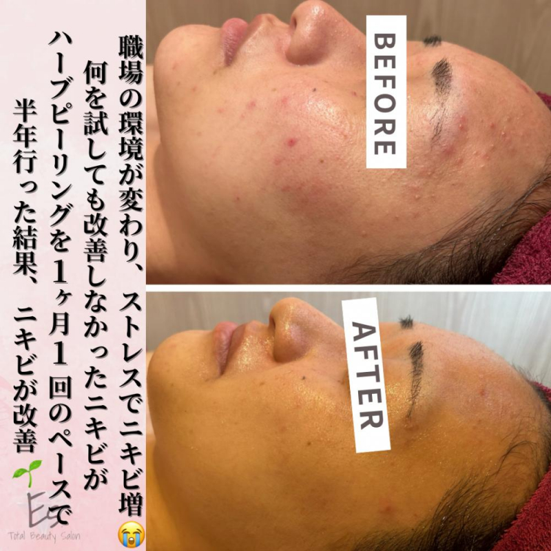 【乾燥を感じる前に！】