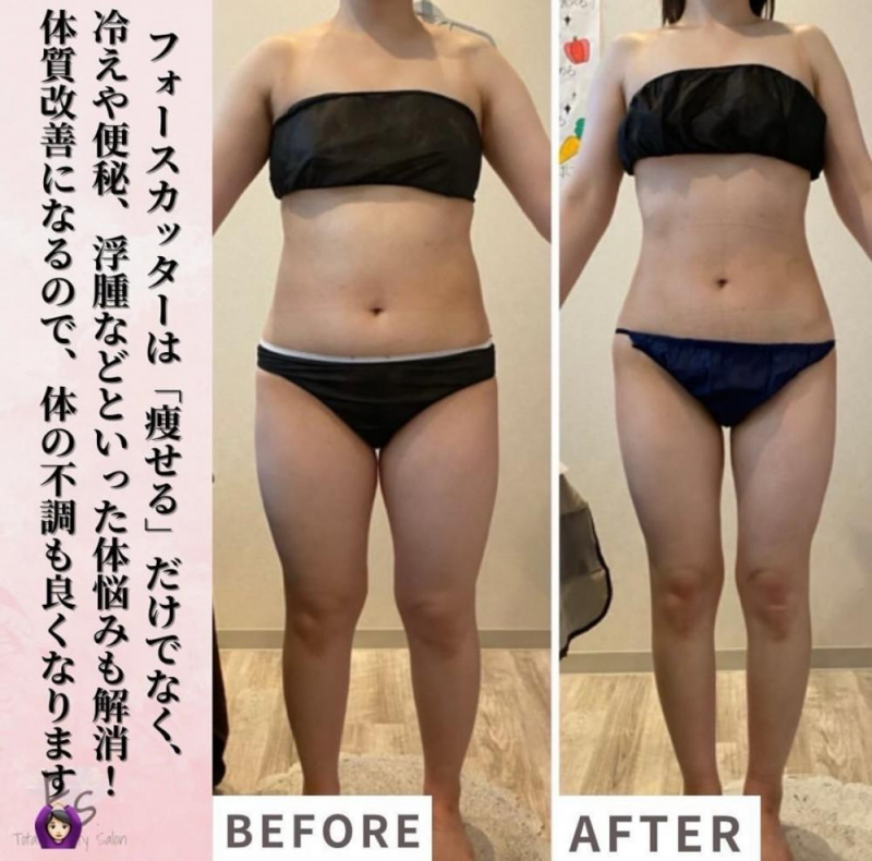 冷え性は改善できます