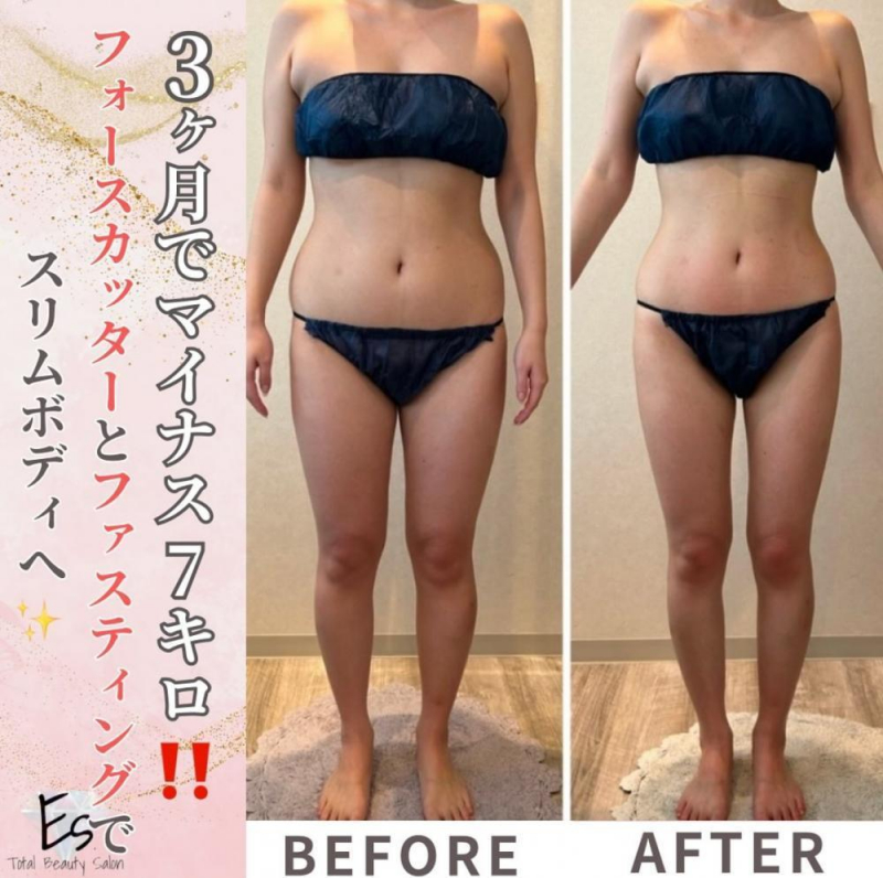 短期間で激痩せ【フォースカッター】
