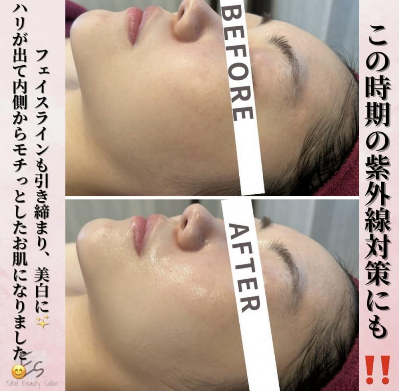 【オプション付けで効率よく綺麗に】