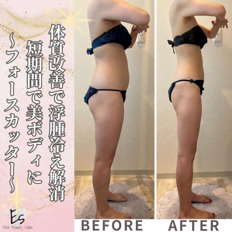 迷ってる暇は無い！体質改善【フォースカッター】